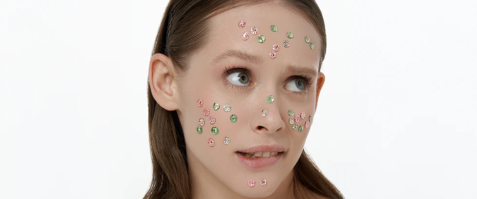 Lots of pimples on my face: why?