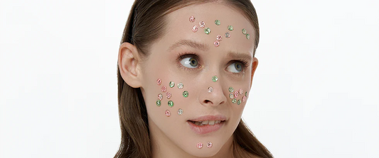 Lots of pimples on my face: why?