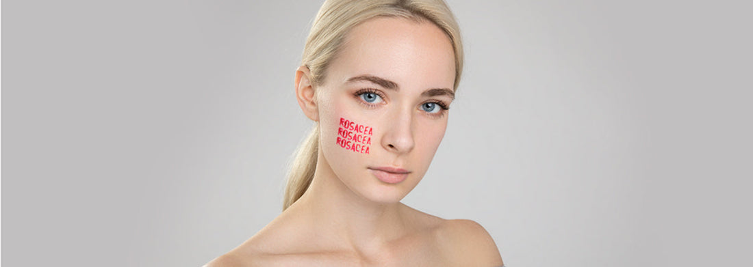 No More Blushing: LIBREDERM Rosaceline Collection